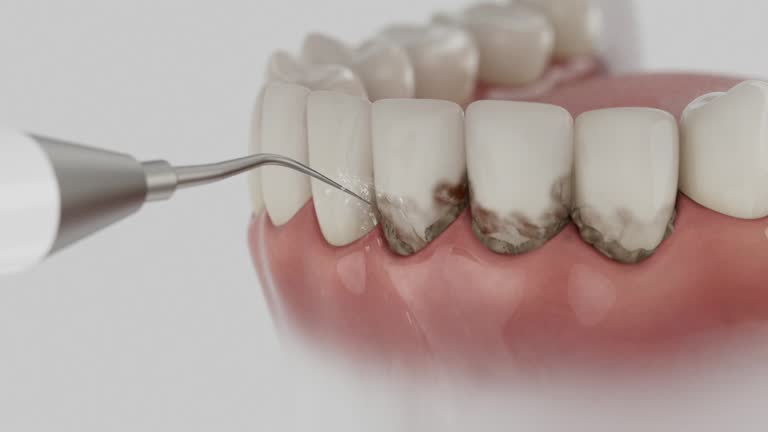Reliable Emergency Dentist contractor in Jackson, SC by Smile Center Dentistry